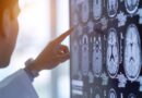 Un ensayo clínico experimental logró una gran recuperación en una paciente con ELA Un ensayo clínico experimental logró una gran recuperación en una paciente con ELA